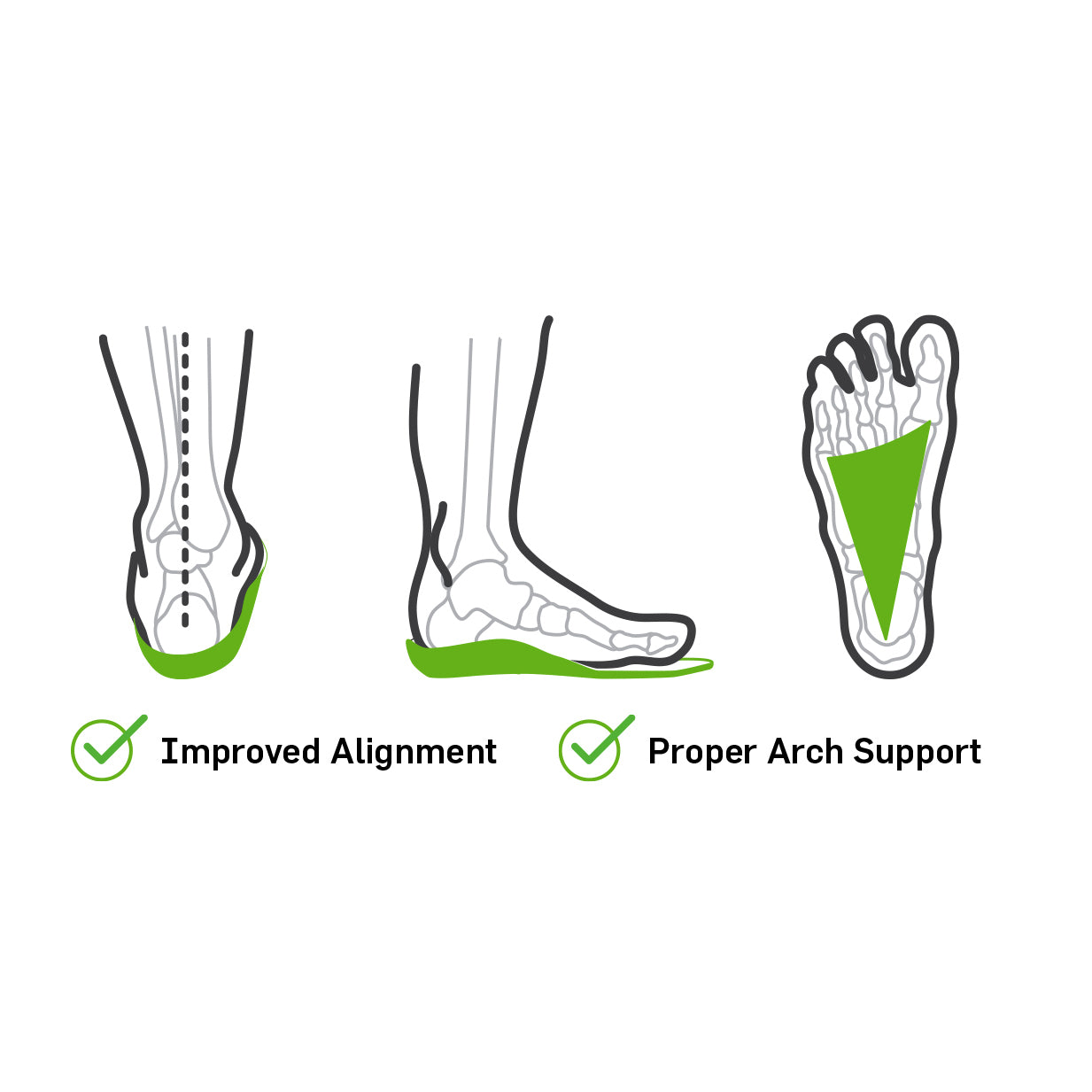 Illustration of foot anatomy with improved alignment and proper arch support highlighted.